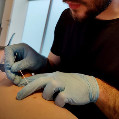 Dry Needling - TVDM